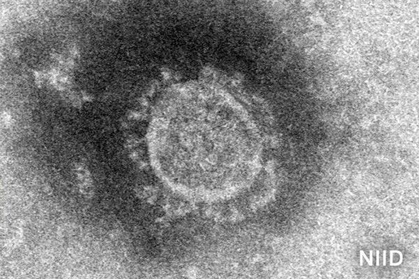 Tokio Suma Ya M S De Personas Infectadas Con El Coronavirus