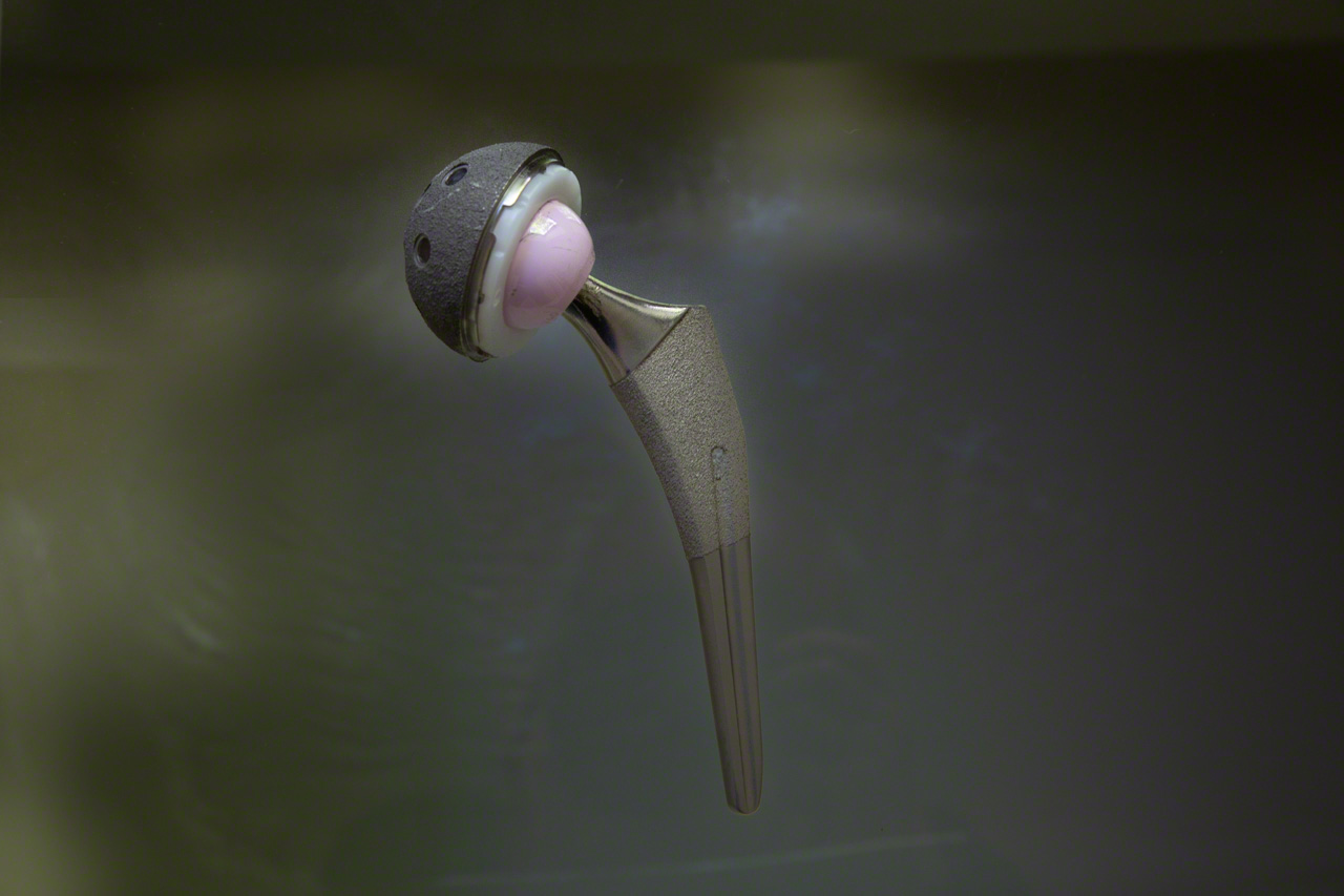 A hip implant system manufactured by the US firm Stryker. The implant weighs about 100 grams more than the bone and cartilage it replaces. (© Ōnishi Naruaki)