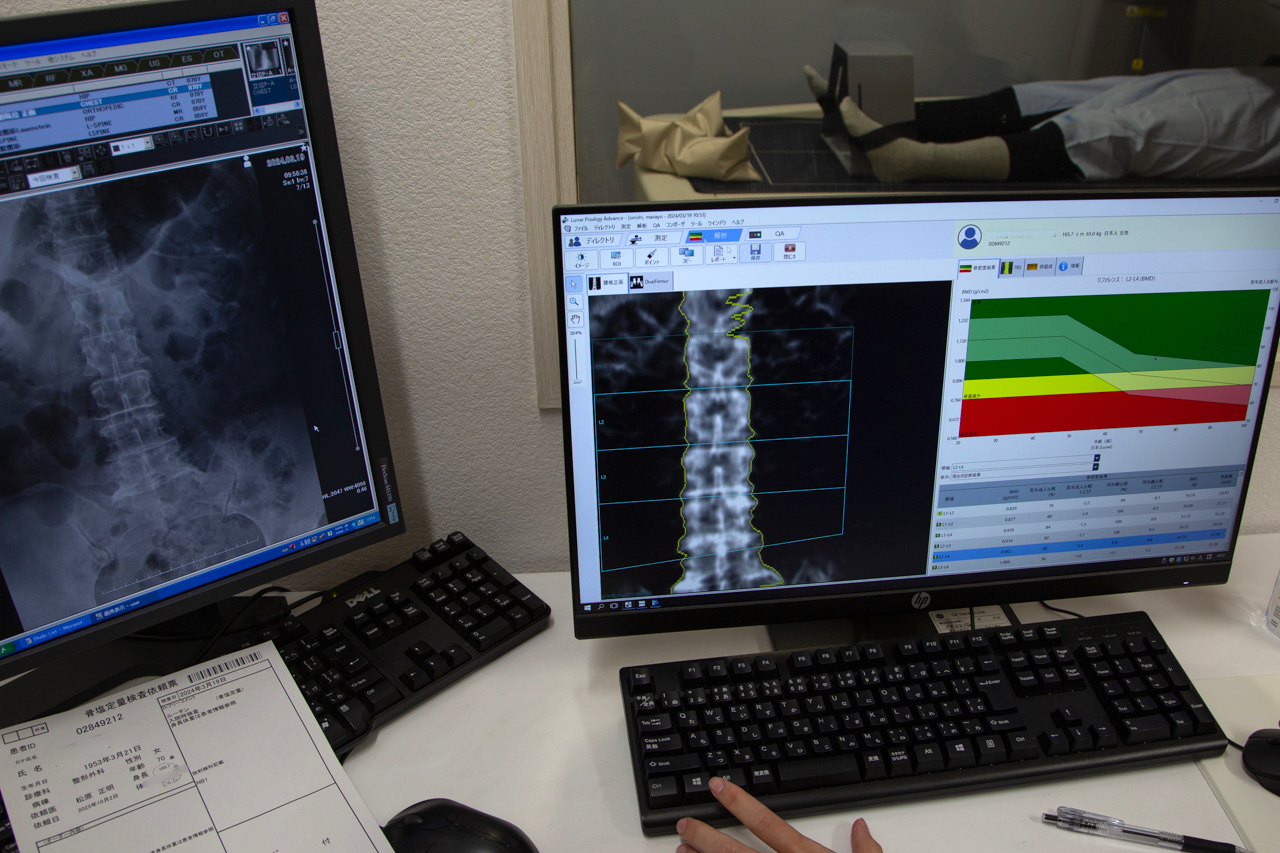 A bone density scan is part of the battery of preoperative tests conducted before hip replacement surgery. (© Ōnishi Naruaki)