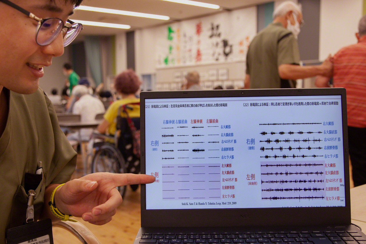 As explained by Murakami, the pink charts on the monitor display the results of electromyography measuring electrical activity in the muscles of a patient’s paralyzed left leg. The light shades of pink on the left side indicate the low level of activity generated by simple flexion and extension of the knee, without the Cogy, while the dark shades on the right show the much stronger electrical activity that accompanies Cogy pedaling. (© Ōnishi Naruaki)