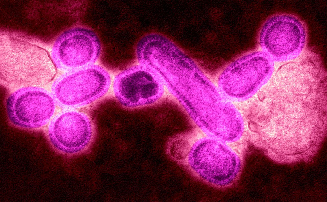 スペイン風邪を引き起こしたインフルエンザA H1N1ウイルスの電子顕微鏡写真。2005年、米国国立感染症センター（CDC）のテレンス・タンペイは、人間から感染する鳥インフルエンザからこのウイルスを再構築することに成功した（Photo By BSIP/UIG Via Getty Images）